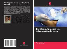 Buchcover von Cintilografia óssea na artroplastia da anca
