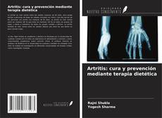 Buchcover von Artritis: cura y prevención mediante terapia dietética