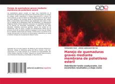Buchcover von Manejo de quemaduras graves mediante membrana de polietileno esteril