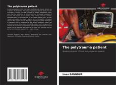 Buchcover von The polytrauma patient