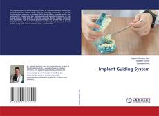 Bookcover of Implant Guiding System