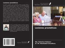 Capa do livro de Lesiones prostáticas 