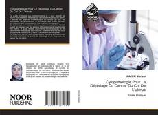 Borítókép a  Cytopathologie Pour Le Dépistage Du Cancer Du Col De L’utérus - hoz