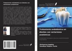 Copertina di Tratamiento endodóntico en dientes con variaciones anatómicas