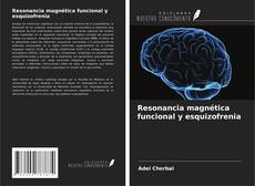 Couverture de Resonancia magnética funcional y esquizofrenia