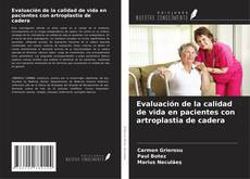 Buchcover von Evaluación de la calidad de vida en pacientes con artroplastia de cadera