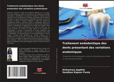 Couverture de Traitement endodontique des dents présentant des variations anatomiques