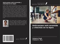 Bookcover of Anticuerpos anti-ceramida y citocinas en la lepra