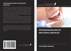 Buchcover von OSTEOINTEGRACIÓN EN IMPLANTES DENTALES