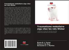 Bookcover of Traumatisme médullaire aigu chez les rats Wistar