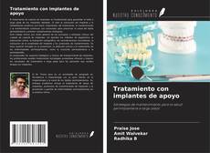 Buchcover von Tratamiento con implantes de apoyo