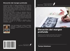 Buchcover von Elevación del margen profundo