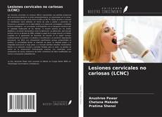 Buchcover von Lesiones cervicales no cariosas (LCNC)