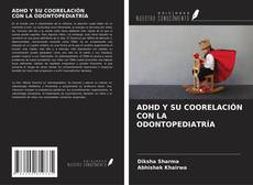 Buchcover von ADHD Y SU COORELACIÓN CON LA ODONTOPEDIATRÍA
