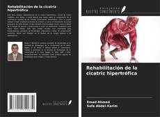 Buchcover von Rehabilitación de la cicatriz hipertrófica
