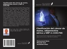 Copertina di Clasificación del cáncer de mama, adiponectina sérica y SNP rs 2241766