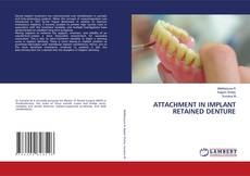 Bookcover of ATTACHMENT IN IMPLANT RETAINED DENTURE