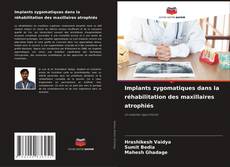 Buchcover von Implants zygomatiques dans la réhabilitation des maxillaires atrophiés
