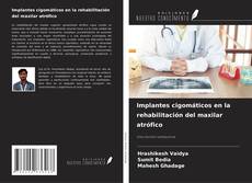 Copertina di Implantes cigomáticos en la rehabilitación del maxilar atrófico