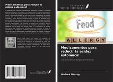 Buchcover von Medicamentos para reducir la acidez estomacal