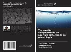Buchcover von Tomografía computarizada de apertura sintonizada en odontología