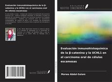 Couverture de Evaluación inmunohistoquímica de la β-catenina y la UCHL1 en el carcinoma oral de células escamosas