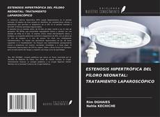 ESTENOSIS HIPERTRÓFICA DEL PÍLORO NEONATAL: TRATAMIENTO LAPAROSCÓPICO kitap kapağı