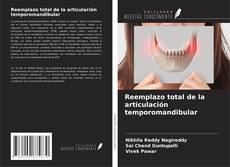 Copertina di Reemplazo total de la articulación temporomandibular