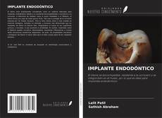 Buchcover von IMPLANTE ENDODÓNTICO