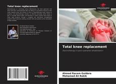 Total knee replacement kitap kapağı