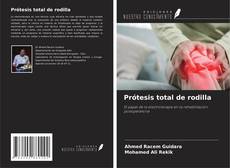 Обложка Prótesis total de rodilla