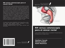 Buchcover von RM versus colonoscopia para el cáncer rectal