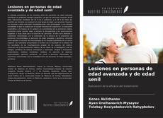 Copertina di Lesiones en personas de edad avanzada y de edad senil