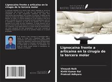Buchcover von Lignocaína frente a articaína en la cirugía de la tercera molar
