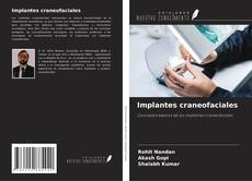 Implantes craneofaciales kitap kapağı