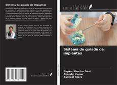 Buchcover von Sistema de guiado de implantes