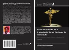 Buchcover von Avances actuales en el tratamiento de las fracturas de mandíbula
