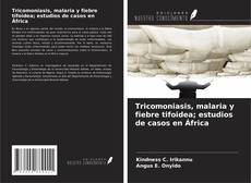 Buchcover von Tricomoniasis, malaria y fiebre tifoidea; estudios de casos en África