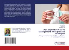 Bookcover of Peri-implant soft tissue Management: Principles and techniques