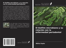 Buchcover von El biofilm microbiano y su relación con la enfermedad periodontal