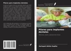 Buchcover von Pilares para implantes dentales