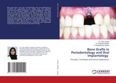Copertina di Bone Grafts in Periodontology and Oral Implantology
