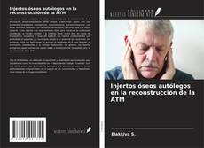 Buchcover von Injertos óseos autólogos en la reconstrucción de la ATM