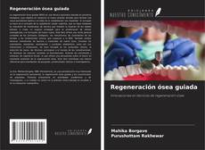 Copertina di Regeneración ósea guiada