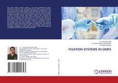 Bookcover of FIXATION SYSTEMS IN OMFS