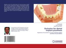 Borítókép a  Occlusion for dental implant prosthesis - hoz