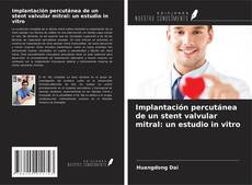 Buchcover von Implantación percutánea de un stent valvular mitral: un estudio in vitro