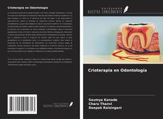 Buchcover von Crioterapia en Odontología