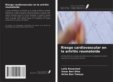 Copertina di Riesgo cardiovascular en la artritis reumatoide