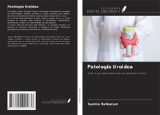 Buchcover von Patología tiroidea